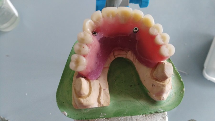 Prueba de dientes 2